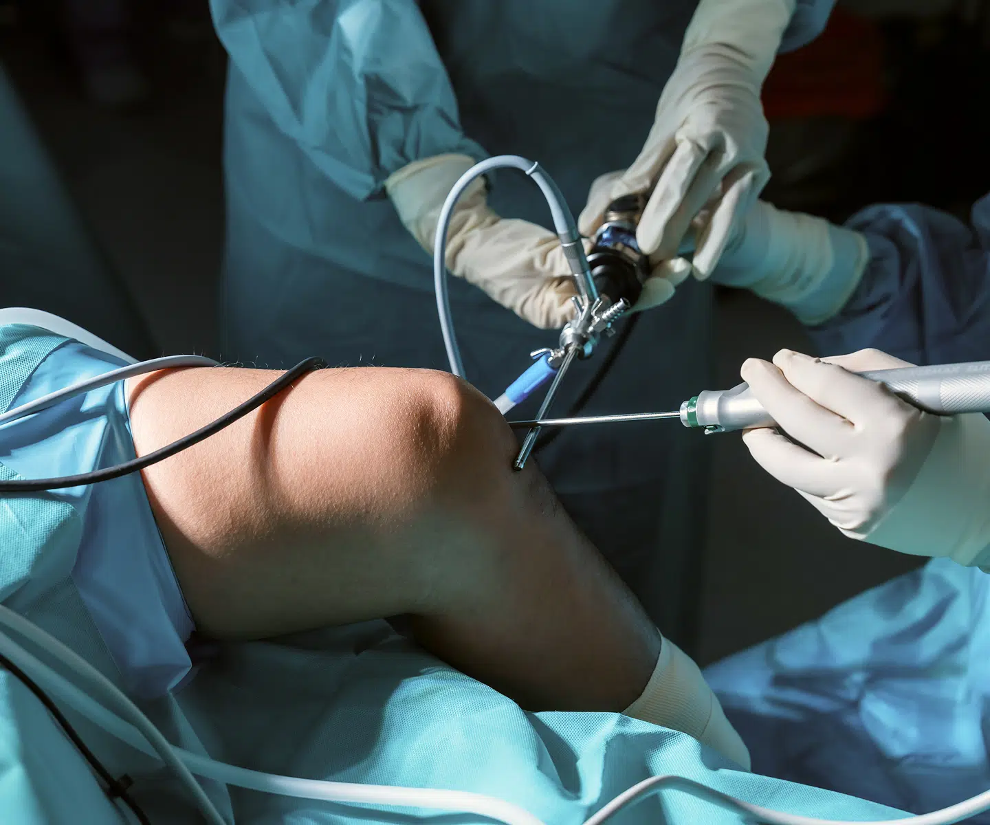 Intervention endovasculaire sur la jambe, réouverture artérielle dans l'AOMI – IRMI
