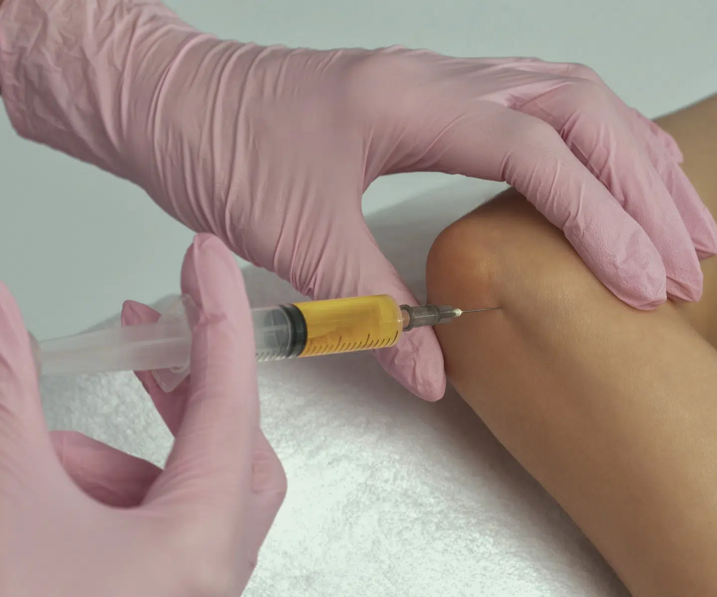 Injection de PRP au niveau du coude, épitrochléite (golfer's elbow) – IRMI