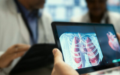 Image 3D du thorax sur tablette, anévrisme de l'aorte et traitement – IRMI