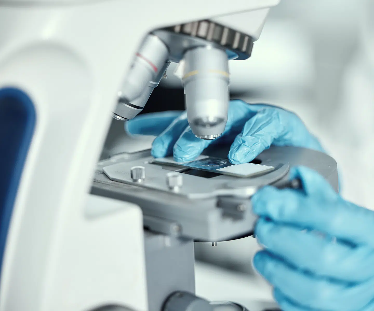 Mains gantées plaçant une lame sous un microscope, biopsie du carcinome hépatocellulaire – IRMI