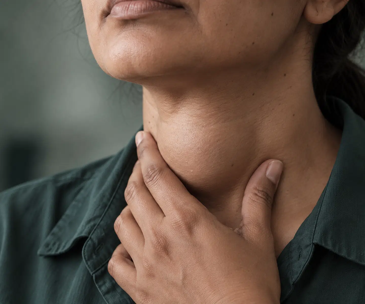 Embolisation des artères thyroïdiennes pour traiter le goitre – IRMI Paris 15